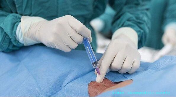 赴美试管掏腰包要花多少？2023年费用全解析与省钱秘籍