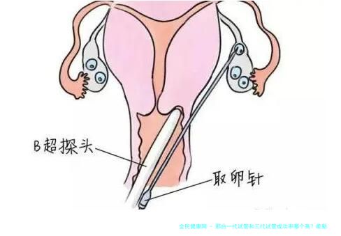 邢台一代试管和三代试管成功率哪个高？最新数据发布