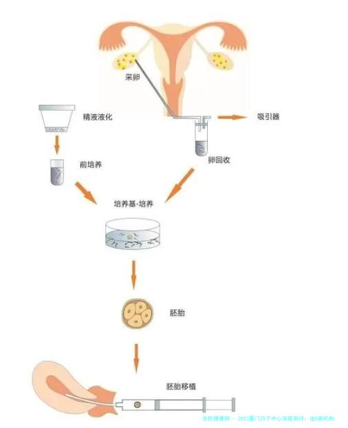 2023厦门月子中心深度测评：这8家机构凭啥上榜？价格差异全解析
