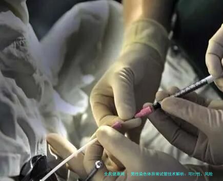 男性染色体异常试管技术解析：可行性、风险与成功率
