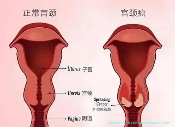 如何提高泰国第三代试管婴儿成功率，附收费参考