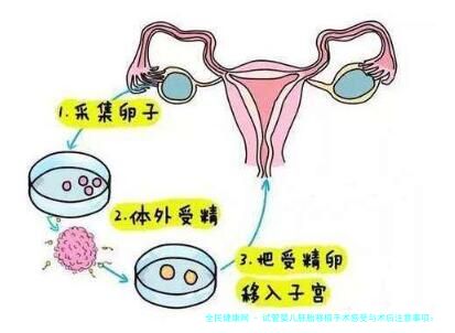 试管婴儿胚胎移植手术感受与术后注意事项：关注疼痛与护理细节