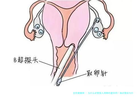 为什么试管婴儿周期吃避孕药？做试管前为什么要吃避孕药