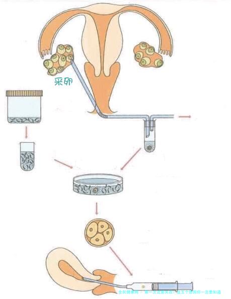 第一次试管失败？这五个原因你一定要知道