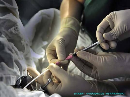 生命密码的缺失之谜：染色体异常如何影响人类健康