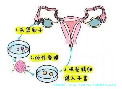 为什么十个高龄孕妇八个血糖偏高呢三大原因你知道几个_孕期八个月血糖高生下的小孩有问题吗！