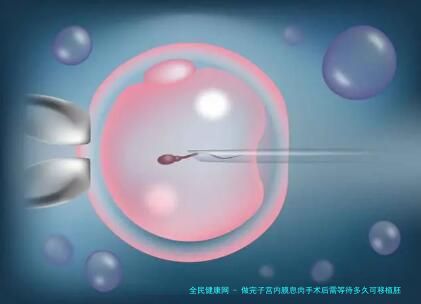 做完子宫内膜息肉手术后需等待多久可移植胚胎呢？