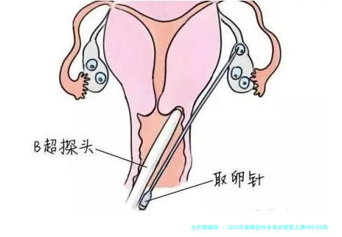 2025年湘雅医院单身试管婴儿费用价目表一览！