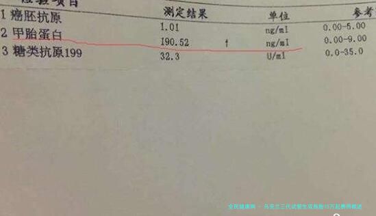 乌克兰三代试管生双胞胎15万起费用概述