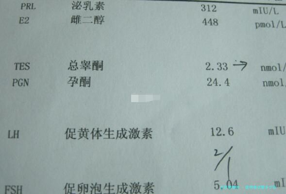 昆明做试管多少钱
