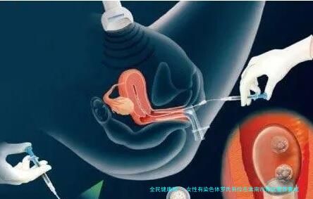 女性有染色体罗氏易位在淮南市做试管养囊成功率高吗？试管移植后需要保胎吗！