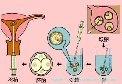 女性有染色体罗氏易位在滦州市做试管养囊成功率高吗？试管移植后需要保胎吗！