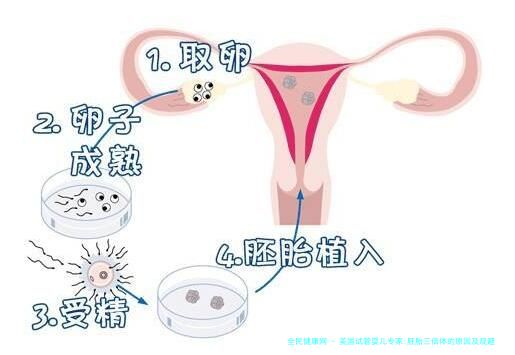 美国试管婴儿专家:胚胎三倍体的原因及规避方案