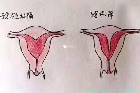 试管婴儿打针几天才能取卵？做试管要打多久针才会排卵？