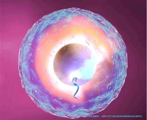 残角子宫不切除会影响试管移植的成功概率吗？