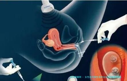 女性在日常生活中应该如何保养卵巢