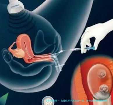 女性保养子宫方法一览，多吃这些食物能增强生育能力
