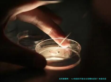 tct检查后可能会出现哪些症状？检查后症状一览