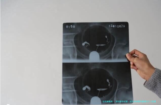 深圳助孕试管：近年来的需求激增与个人故事
