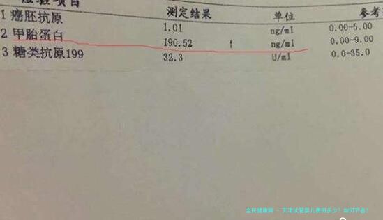 天津试管婴儿费用多少？如何节省？