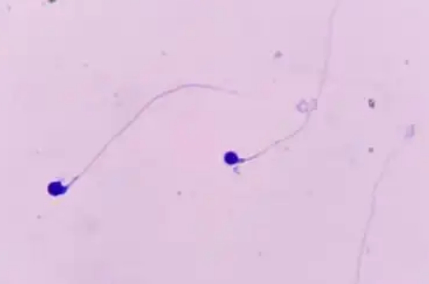 36岁男性精子活力差畸形率偏高能做第三代试管婴儿吗？