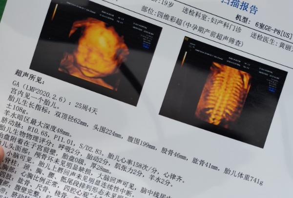 四维彩超单子看男孩女孩的诀窍是看胎心吗？