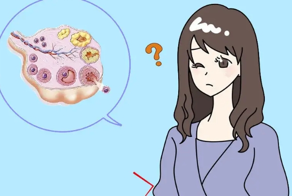多囊备孕期间饮食要少吃精制糖