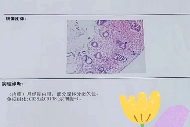 CD38阳性要先治疗再做试管