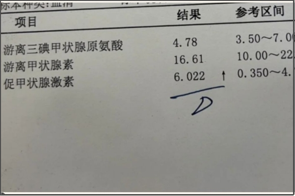 正常备孕的人甲状腺激素在2.5mIU/L以下