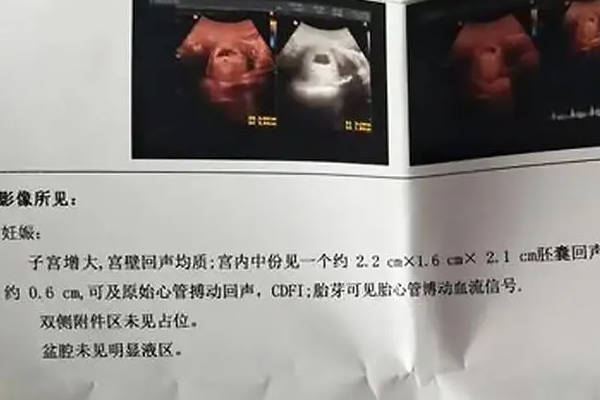 三个数据中一个相差大是男孩