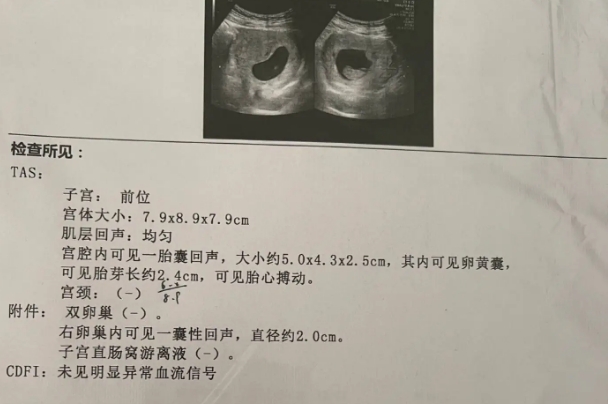 b超单上的x和y可以判断胎儿是男是女请问在哪里可以找到?
