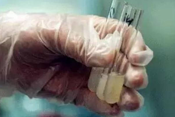 买别人的精子做试管价格到底如何，供精做人授好还是试管好