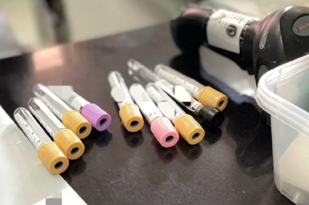 做试管前需要做什么检查，除了基础的还要做传染病排查
