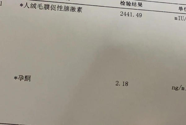 备孕期间不一定需要检查孕酮
