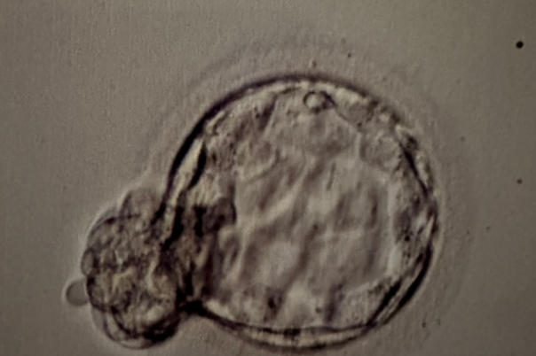 移植囊胚三大禁忌曝光！这些错误九成人都踩过