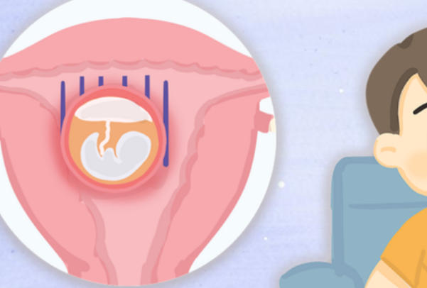 胚胎着床腹部隐隐作痛是正常的