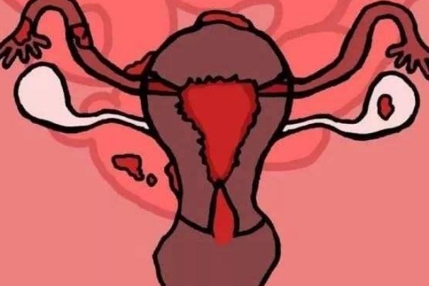 子宫环境异常会导致不孕不育