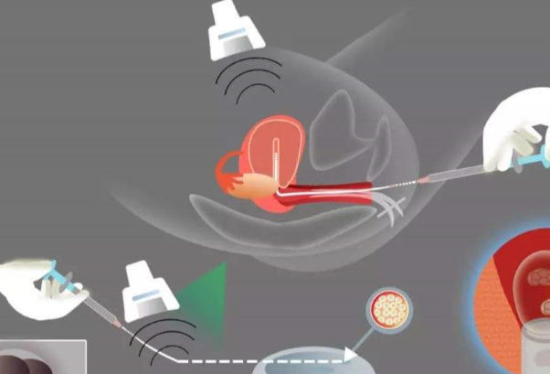 胚胎等级越高质量越好