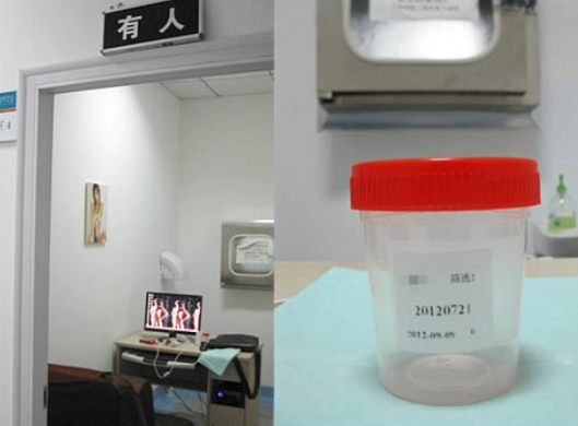 胎停后男性需要做精液检查