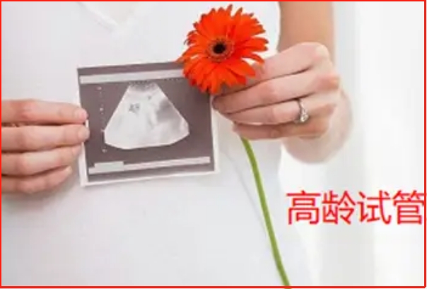 高龄女性可以做试管婴儿