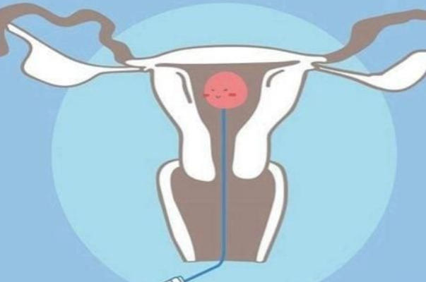 胚胎移植后可以适当休息