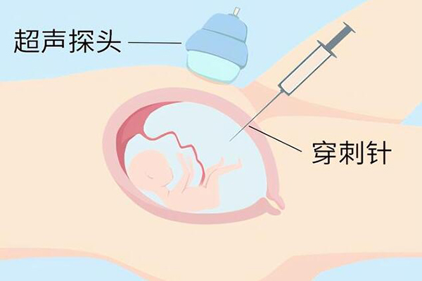 为什么有的人说真后悔做唐氏筛查和羊水穿刺呢？