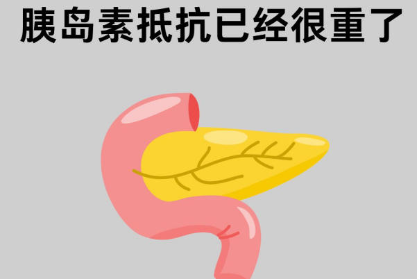 胰岛素抗体能查看糖代谢率