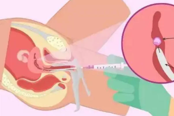 胚胎质量会影响移植的成功率