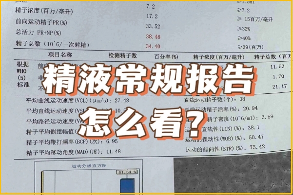 男生备孕检查哪些项目，精液分析、传染疾病等