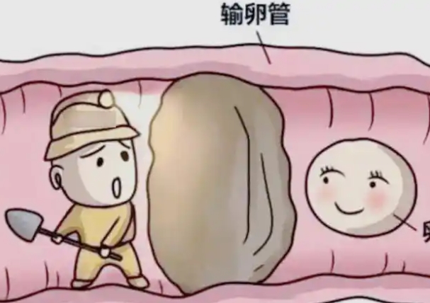 38岁输卵管堵塞八年还能做试管吗？
