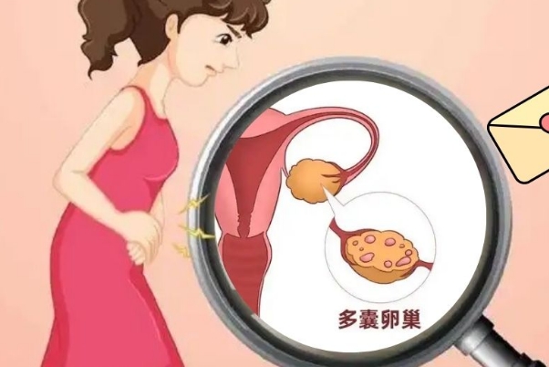 多囊患者可以通过促排药物进行排卵