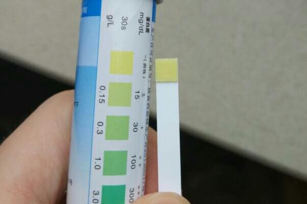 一分钟带你了解前白蛋白检查方法，是不是抽血看完就知道