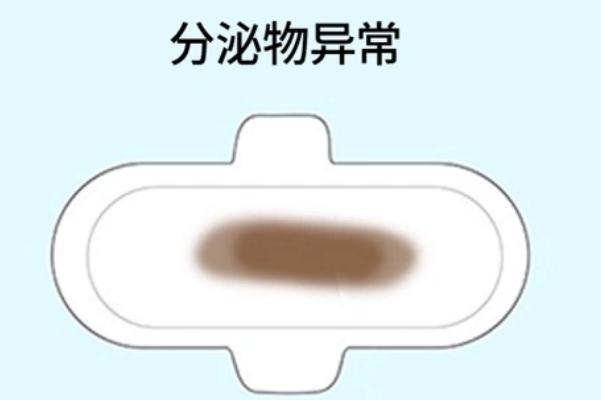 移植16天有褐色分泌物，可能是胚胎着床也可能的流产征兆