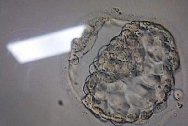 做试管婴儿为什么说囊胚移植能够提高胚胎着床的成功率?